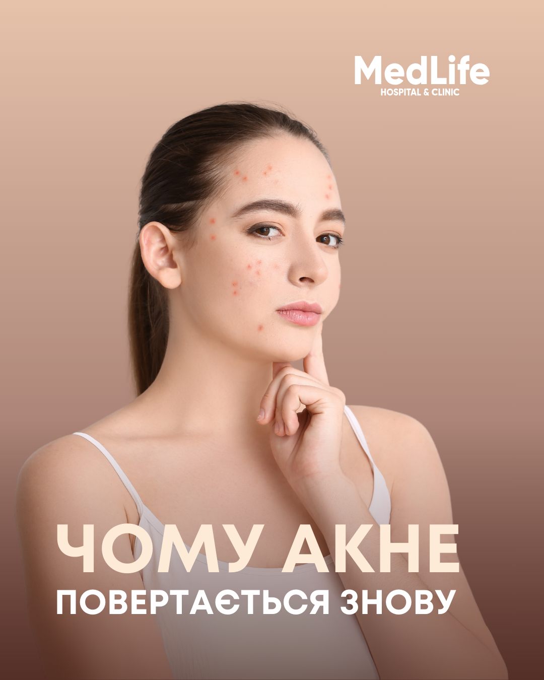Чому акне повертається знову?
